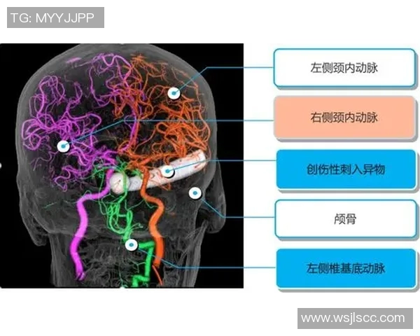 深入分析北京排球队防反战术的独特魅力与实战应用